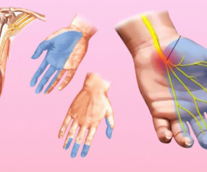 Онемение рук: причины, почему немеют руки, это опасные симптомы!