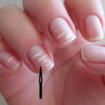 Белые полоски на ногтях: Что означают, причины появления и способы лечения
