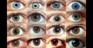 Почему глаза разного цвета